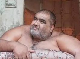 После липосакции умер самый тяжелый мужчина в Пакистане весом 330 кг липосакция отзывы