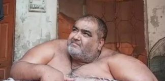 После липосакции умер самый тяжелый мужчина в Пакистане весом 330 кг липосакция отзывы